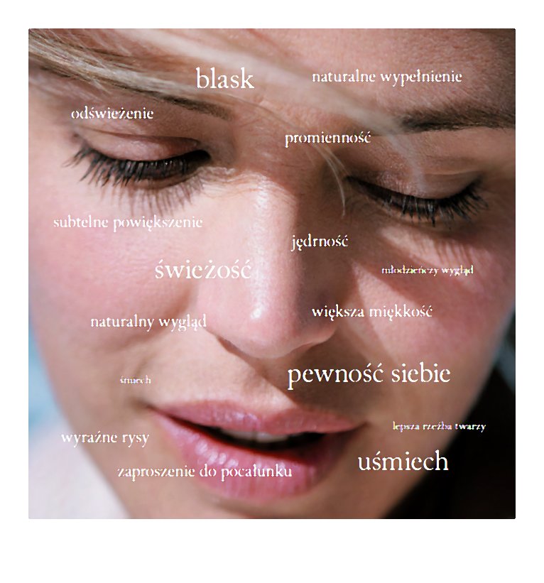 JUVÉDERM® VOLIFT® with Lidocaine
